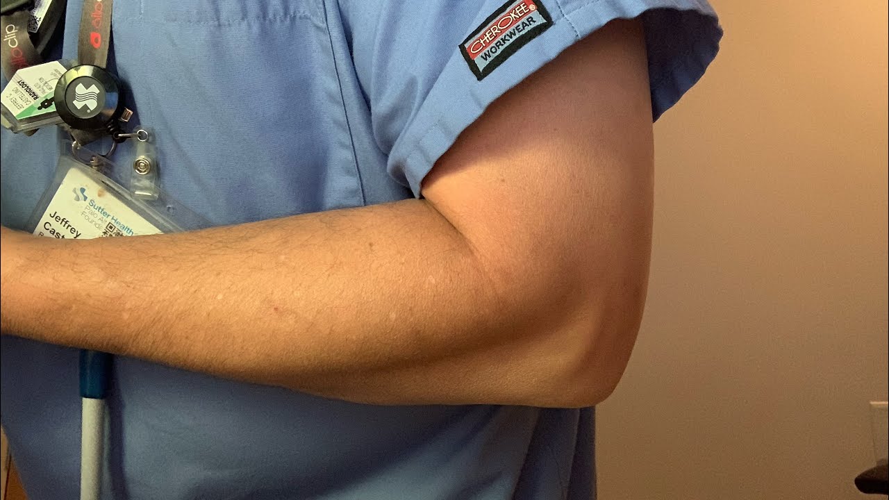 HowTo Take A Upright Trauma (Flexed) Elbow XRay Series Perfectly