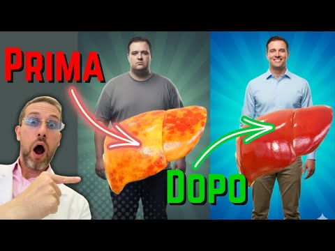 Video FEGATO GRASSO? Evita QUESTI 3 CIBI come LA PESTE!