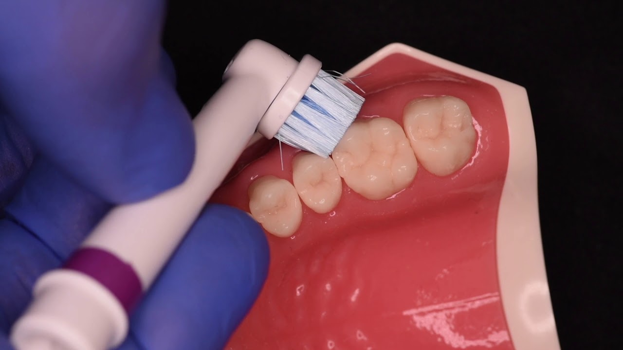 Hoe kan ik efficiënt poetsen met een elektrische tandenborstel?