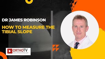 Dr James Robinson - How to Measure the Tibial Slope