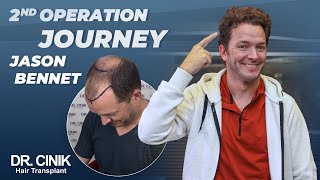 Jason Bennet 2Nd Operation Journey