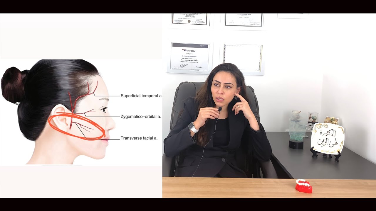 كيفية حقن الفلر في مناطق الوجه المختلفة بأمان👌 تجنب الشرايين الرئيسية في الوجه