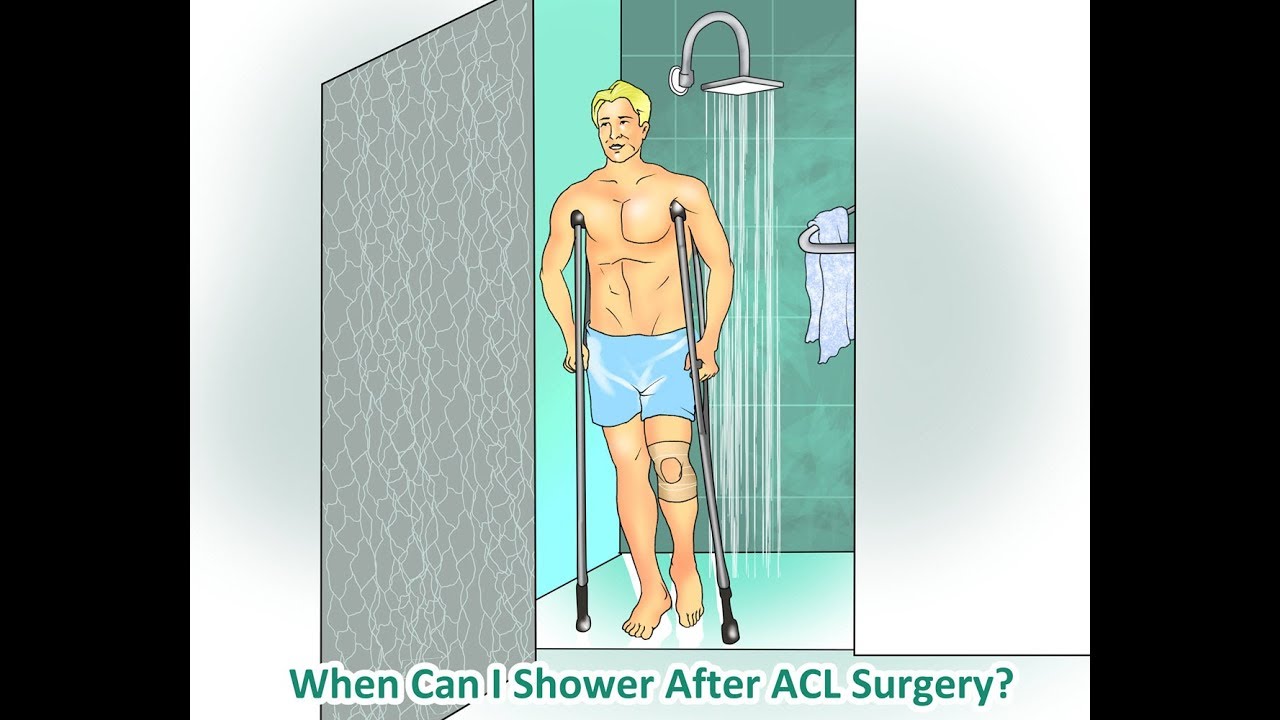 When And How Can I Shower After Acl Surgery