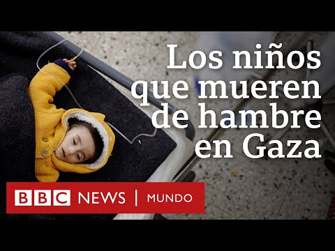 Los niños que mueren de hambre en Gaza | BBC Mundo