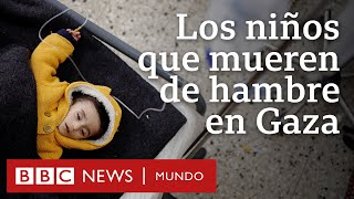 Los niños que mueren de hambre en Gaza | BBC Mundo