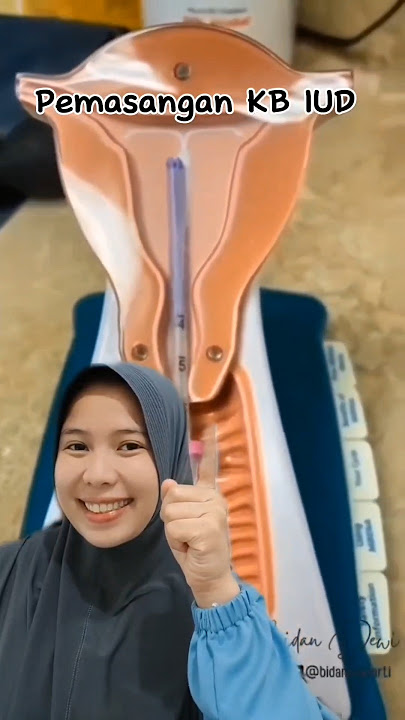 Pemasangan KB IUD