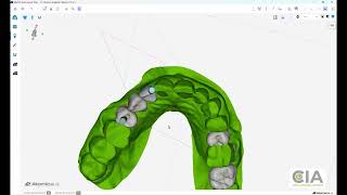 Atomica basics7-Making angled abutments