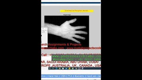 Hand vein classification CNN _ Hand Vein _ Dorsal Vein recognition _ CNN _ PCA _ Biometric - MATLAB