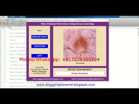 Skin Disease Detection Using Deep Learning Matlab Project With Source Code Skin Disease Analysis