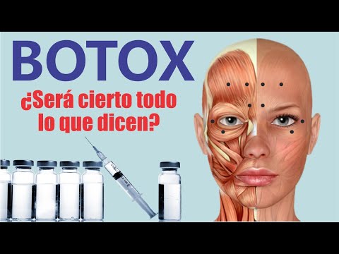 MENTIRAS y VERADES de la TOXINA BOTULÍNICA 💉 mitos del BOTOX ❤️ Adiós ARRUGAS 🔥  Dr JIMMY PUMAMANGO