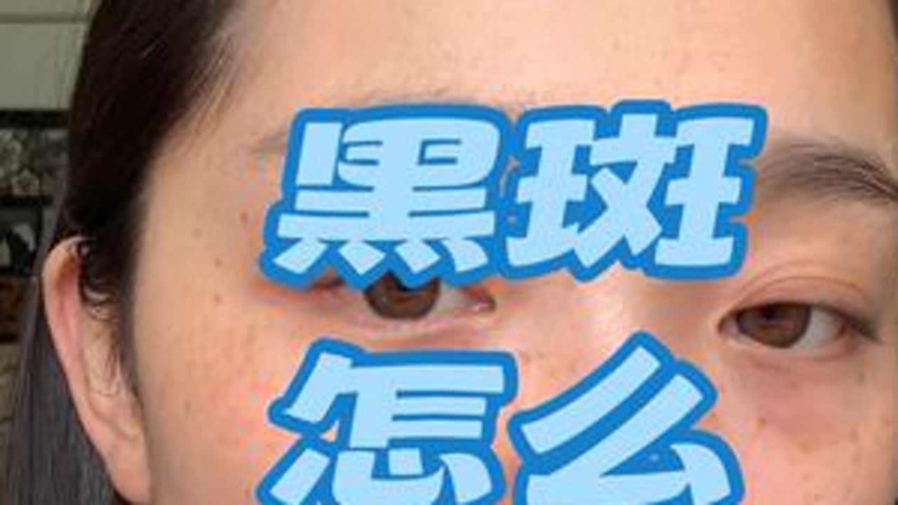 #遮斑#遮胎记#遮瑕膏#maluwilz遮瑕膏 #遮黄褐斑