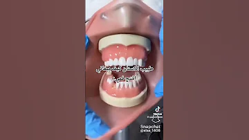 طبيب الأسنان كيف يبغوني افتح فمي ههههههههه 
