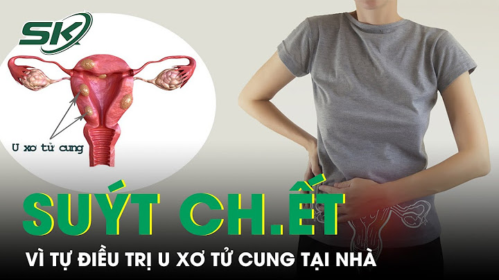 Nhân xơ tử cung là bị bệnh gì