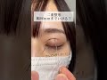 【二重整形】二重整形何mmまでいける?#shorts