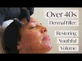 Dermal Filler for Over 40s 💆‍♀️ Restoring Youthful Volume