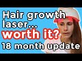 Irestore hair growth laser 18 month update is it worth it dr dray