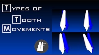 Types Of Tooth Movements | Essential Biomechanics