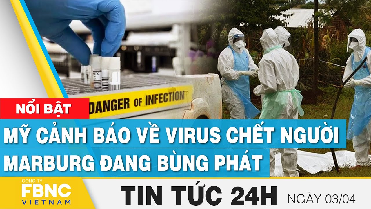 Tin tức 24h mới nhất 3/4 | Mỹ cảnh báo về virus chết người Marburg đang bùng phát  | FBNC