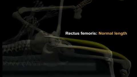 The Thomas Test  Muscle&Motion