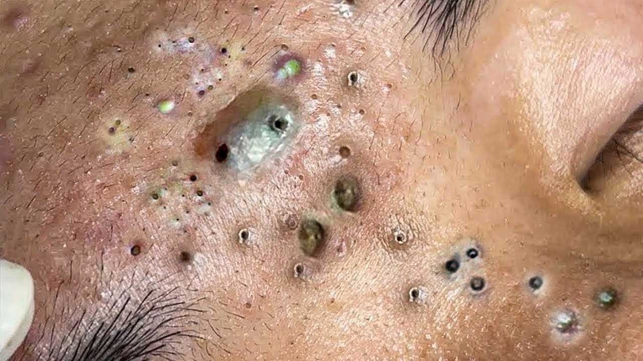 𝑺𝒐𝒐𝒕𝒉𝒊𝒏𝒈 𝑭𝒂𝒄𝒊𝒂𝒍 𝑻𝒓𝒆𝒂𝒕𝒎𝒆𝒏𝒕 𝒇𝒐𝒓 𝑺𝒕𝒓𝒆𝒔𝒔 𝑹𝒆𝒍𝒊𝒆𝒇 | 𝑫𝒆𝒆𝒑 𝑪𝒍𝒆𝒂𝒏𝒊𝒏𝒈 & 𝑪𝒂𝒍𝒎𝒊𝒏𝒈 𝑴𝒂𝒔𝒔𝒂𝒈𝒆 𝒂𝒕 𝑳𝒖𝒙𝒖𝒓𝒚 𝑺𝒑𝒂 #48136