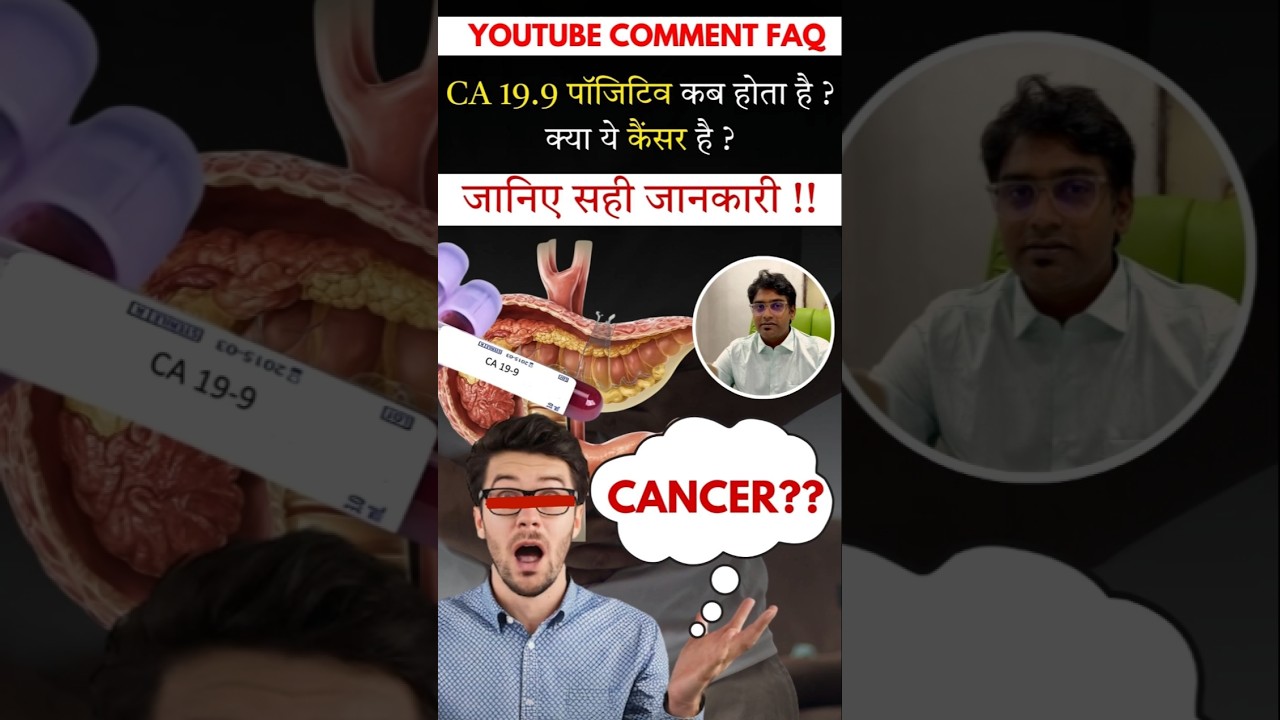 CA 19.9 kab positive hota hai? | what is the Ca 19.9 marker test | pancreatic cancer | ca 19.9 range