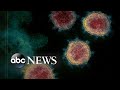 Case of ‘community spread’ of coronavirus in US raises concerns | WNT