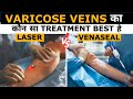 Laser vs venaseal for varicose veins  in hindi  dr gaurav gangwani