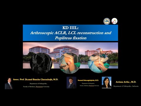 ACL LCLPopliteusผ่าตัดเอ็นไขว้หน้าเอ็นด้านข้างฉีกA/Prof.BanchaChernchujit บัญชาชื่นชูจิตต์TUThailand