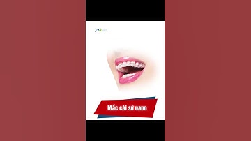 Niềng răng 4.0 tại bệnh viện JW tự tin khoe cá tính #shorts #niengrang #benhvienjw