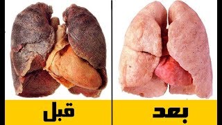 هل تعلم ماذا سيحدث لك إذا توقفت عن التدخين فجأة ..؟!!😱😱 screenshot 4