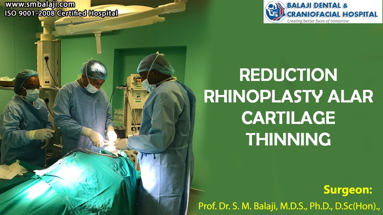 Reduction Rhinoplasty Alar Cartilage Thinning - YouTube