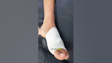 65% ba mẹ mắc 3 sai lầm này khi sơ cứu vết thương cho con | Dược sĩ Trương Minh Đạt