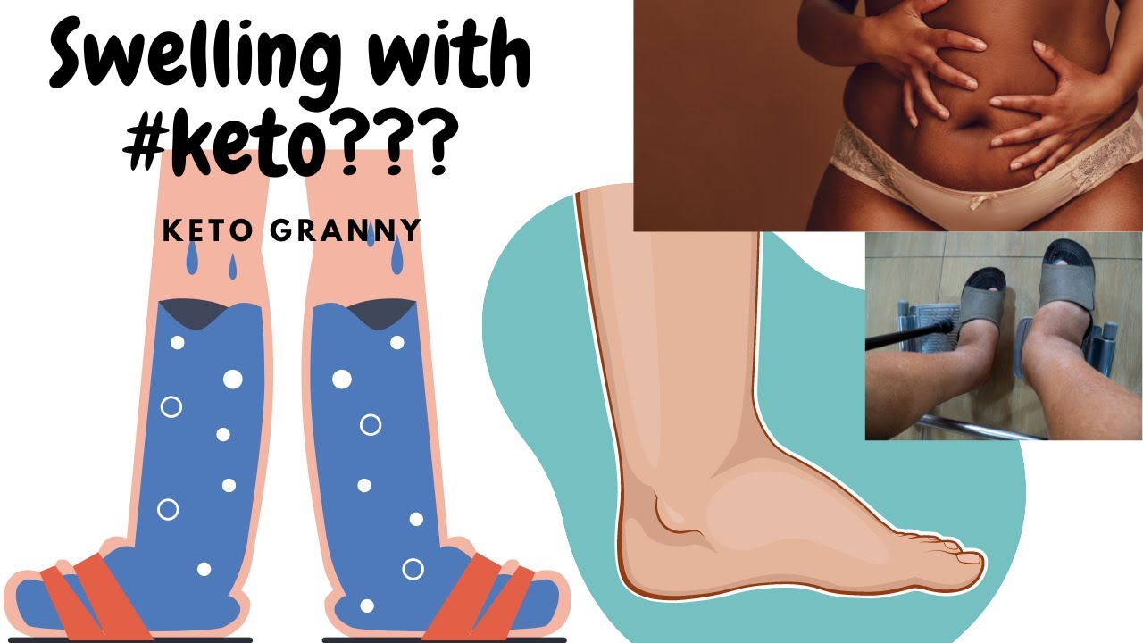 Keto Granny vacation mishap, Hospitalization after vacation, Rapid