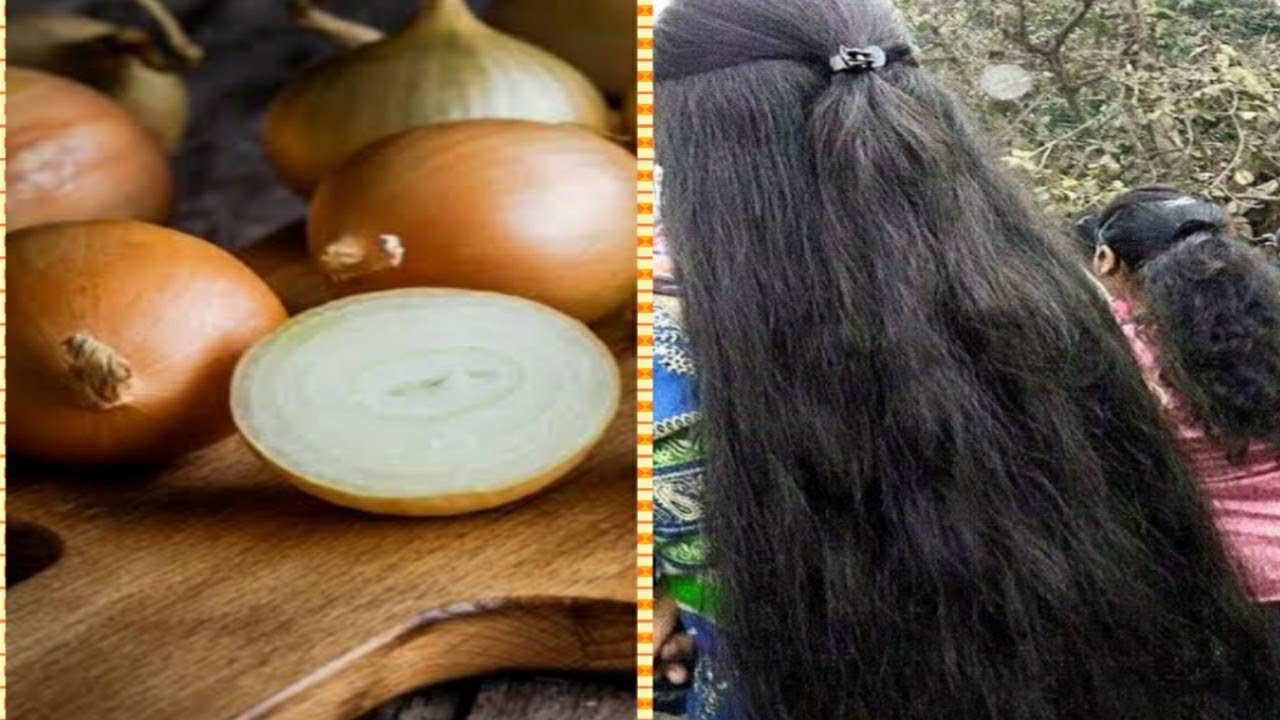 How to use onion juice and hair growth in telugu YouTube