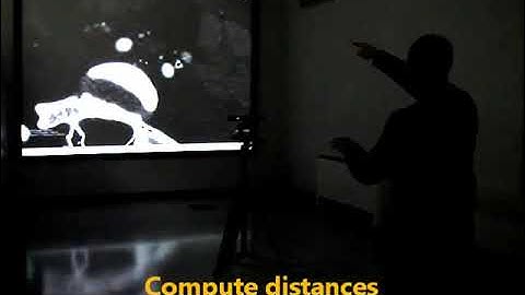 MITO - Kinect based medical image exploration