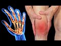 Knee Pain Treatment: How To Cure Knee Pain Within 76 Hours! Remedies for Knee Pain! Arthritis Pain