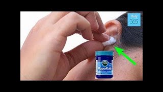 Metti del Vicks VapoRub su un batuffolo di cotone e posizionalo nell'orecchio