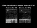 Sharper ultrasound images could improve diagnostics
