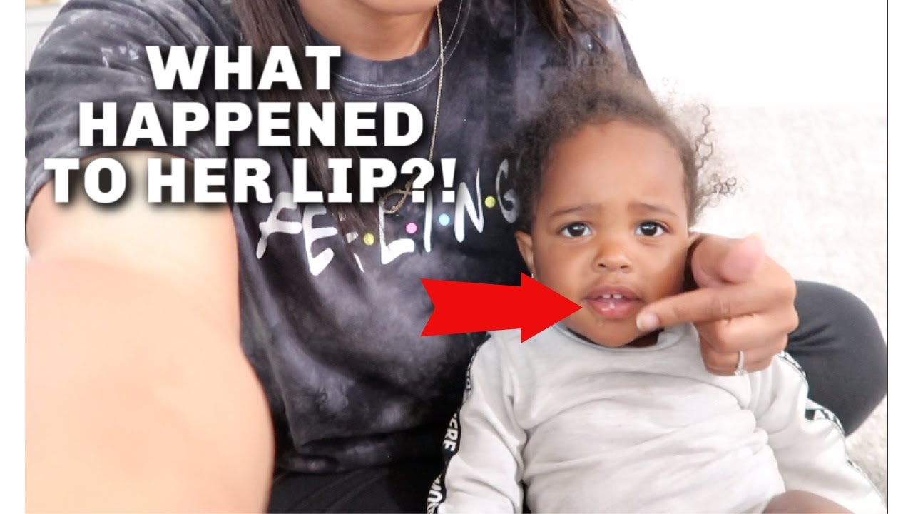 WHAT HAPPENED TO HER LIP?! - YouTube