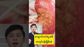 ဆ အမပထနရင ဘဖစလ နမရ