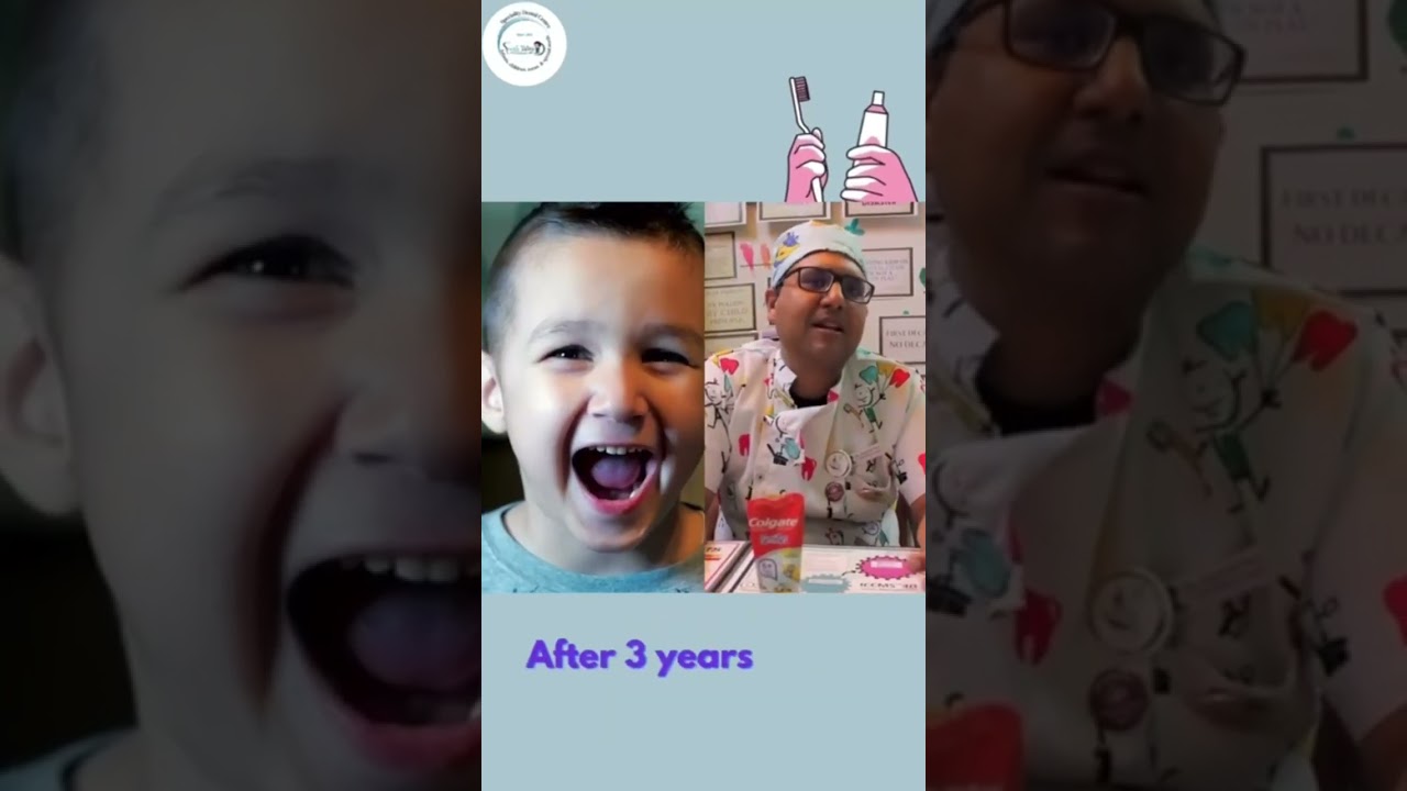 Tooth Tales Dental Home - How much Toothpaste should be used ?