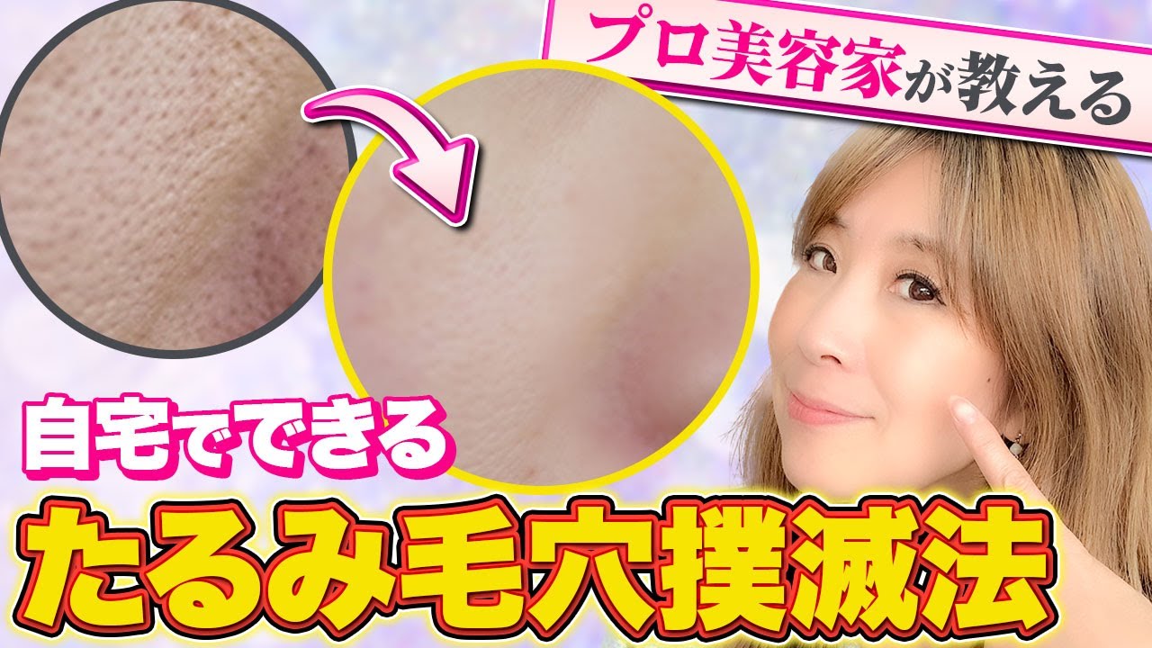 【プロ美容家が教える老化防止】頬の たるみ毛穴 を自力で治す方法！原因から対策まで紹介！！ - YouTube
