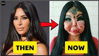 15 Black Celebrity Plastic Surgery Disasters That Ruined Their Looks | Then and Now 2026