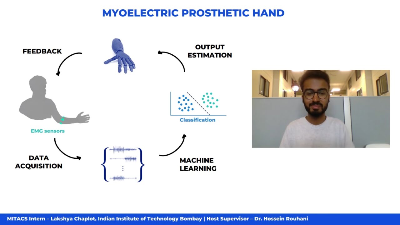 Myoelectric Prosthetic Hand | Neuromuscular Control and Biomechanics ...