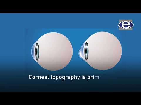 Corneal Topography | The Eye Foundation | Dr. Visesh N | #eyecareservices #eyetreatment
