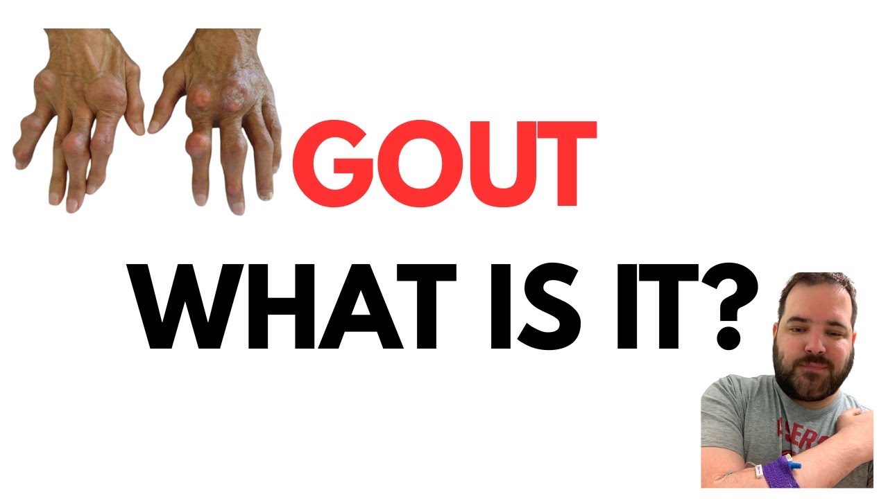 What is Gout?  26 Years of First-Person Experience Condensed into 8 Minutes