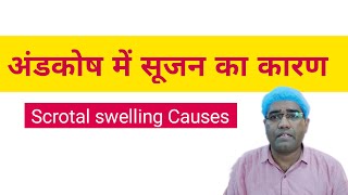 Scrotal (testicular) Swelling Causes Hindi| अंडाशय में सूजन का कारण | Andkosh Me Sujan Kyun Hoti Hai Resimi