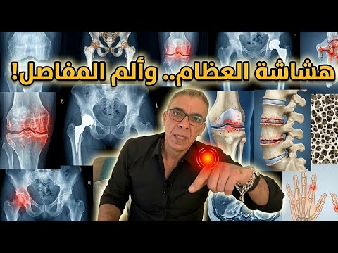 خشونة المفاصل وألم العظام: كيف تتخلص من الألم وتستعيد حركتك؟ د. ضياء العوضي 🩺.