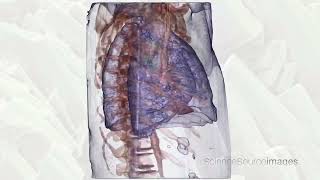 Medical Stock Video Reel from Science Source Images & Video