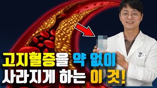 이걸 꾸준히 드시면, 고지혈증이 약 없이 사라집니다. (콜레스테롤 수치를 낮추는 검증된 영양제)